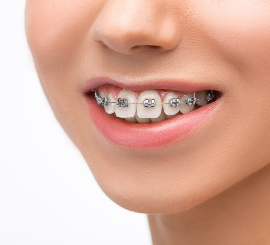 Orthodontics & Braces